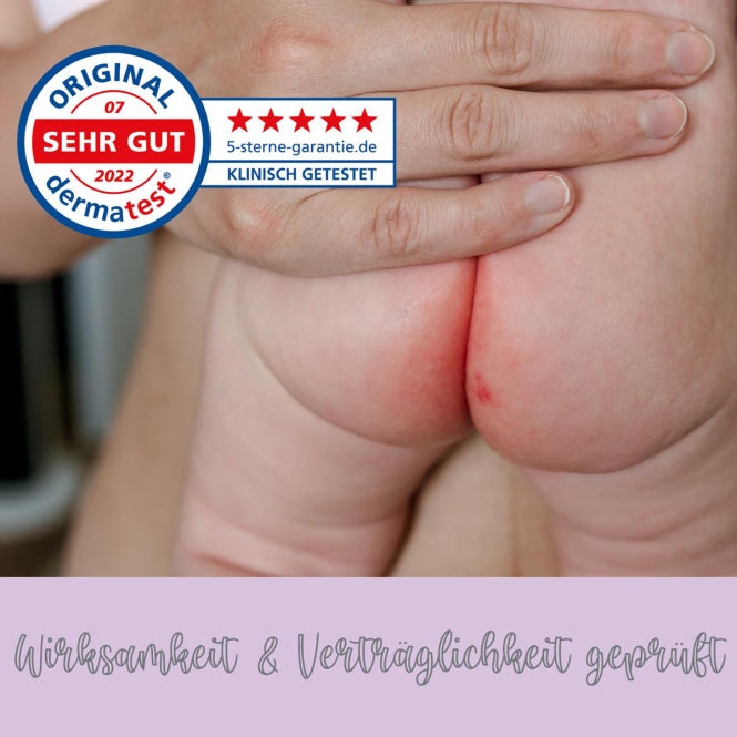 Millis Zaubertücher – Natürliche Hilfe bei Windelausschlag; empfindlicher Babyhaut (25 Stück) Millis